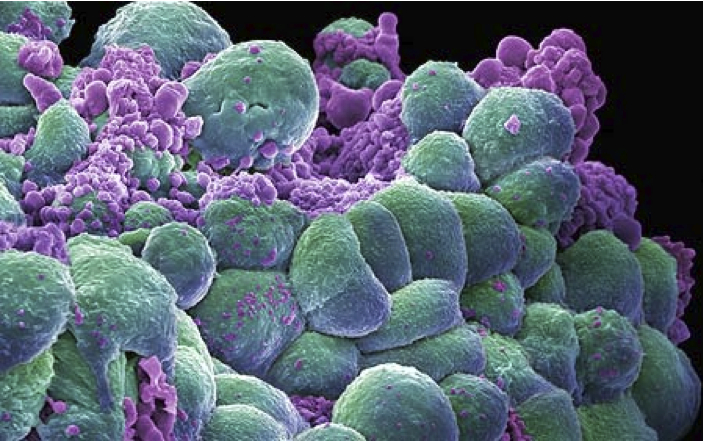 DR. T. SIMONCINI, oncoloog. Een nieuwe kijk op kanker.