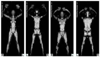 VS senatoren, bodyscanner gevaarlijk!