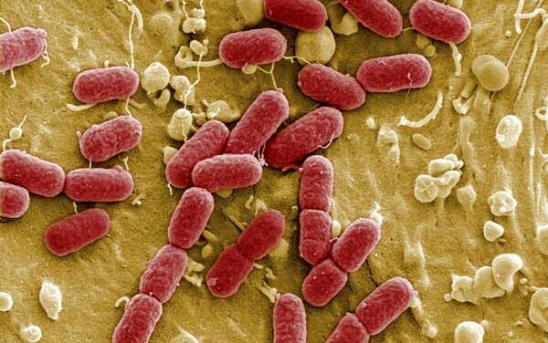 Oorzaak EHEC bacterie volgens Ongeordend